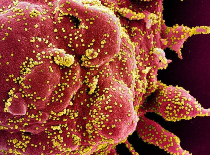 Coronavírus pode se multiplicar nos neurônios, mostra estudo da Unicamp