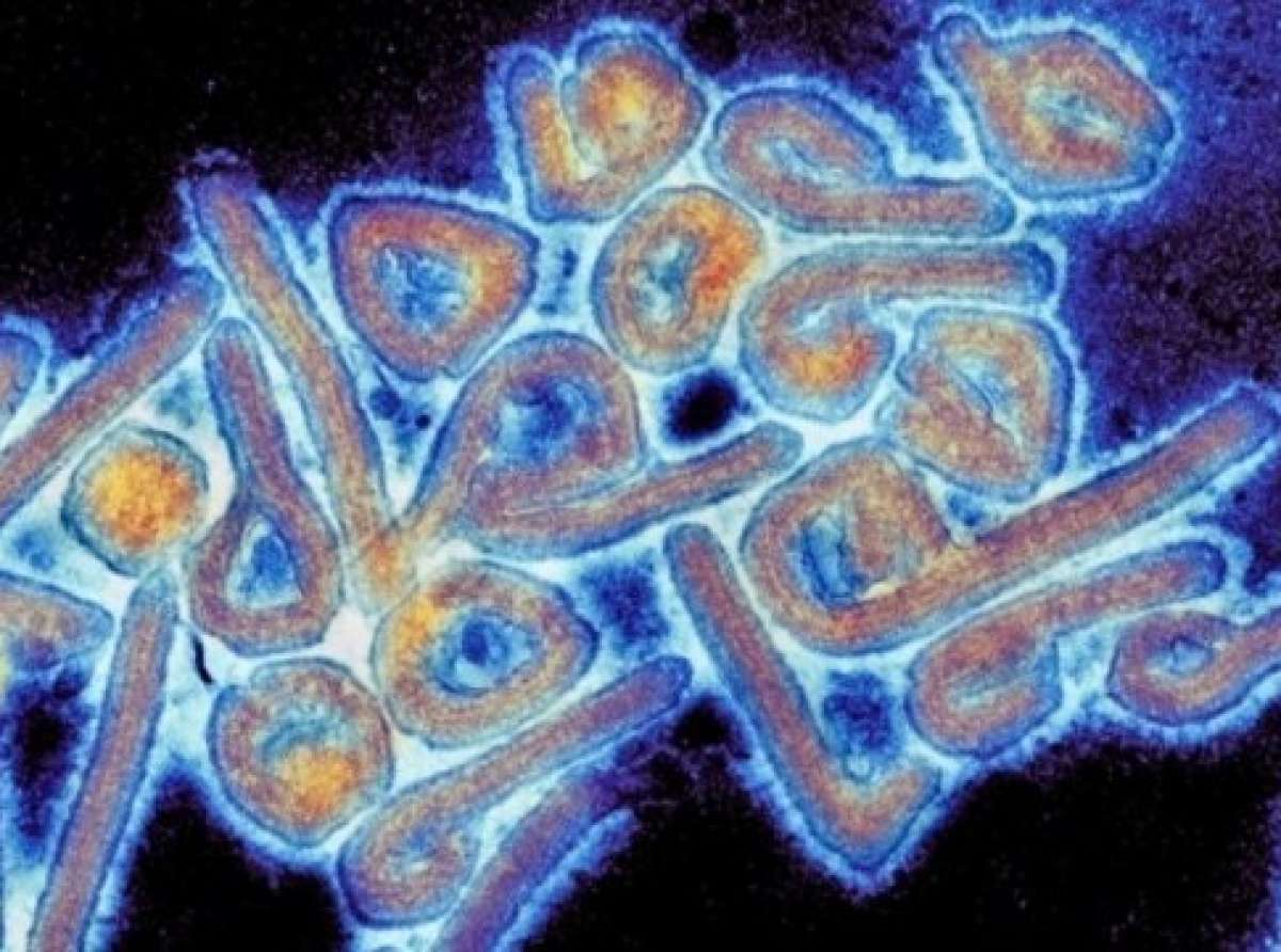 Vírus mortal que causa sintomas semelhantes aos do Ebola é encontrado na Bolívia e é transmissível entre humanos
