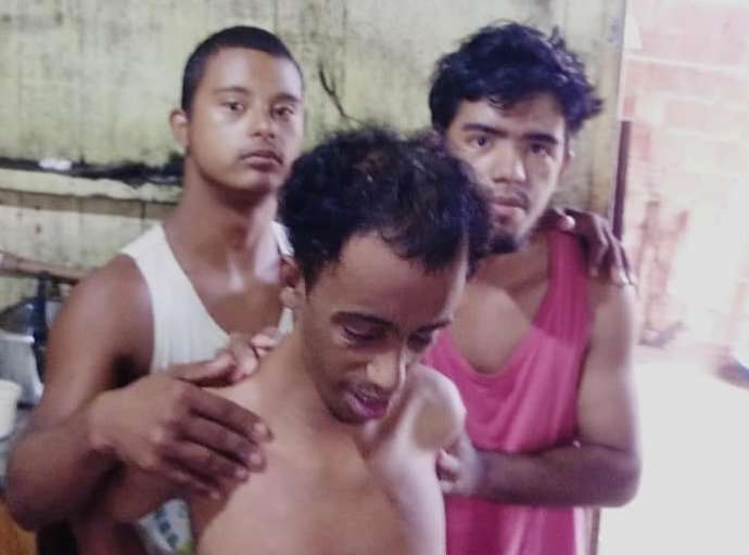 A dura vida dos três irmãos deficientes do Acre que não tem nada para comer