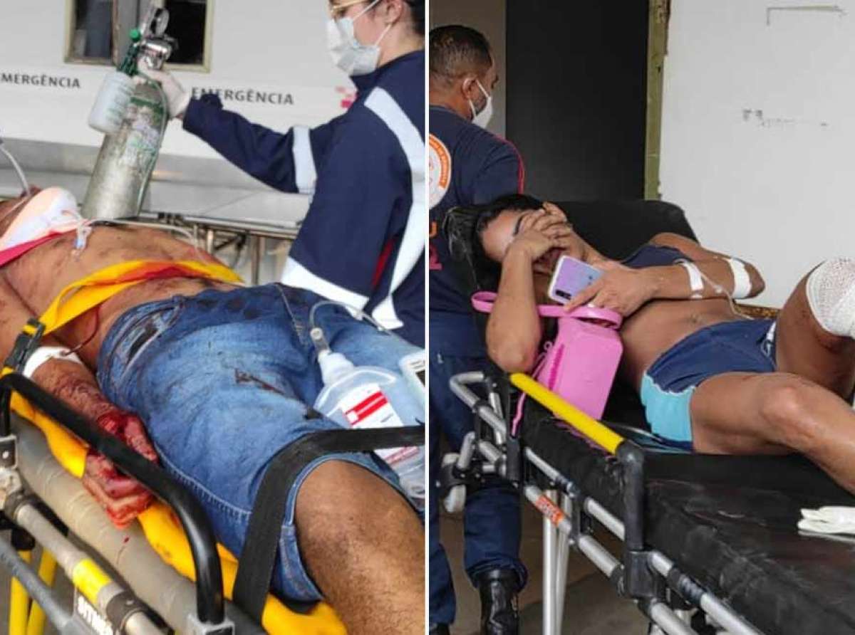 Casal leva oito tiros após criminosos armados invadirem apartamento na Baixada da Sobral