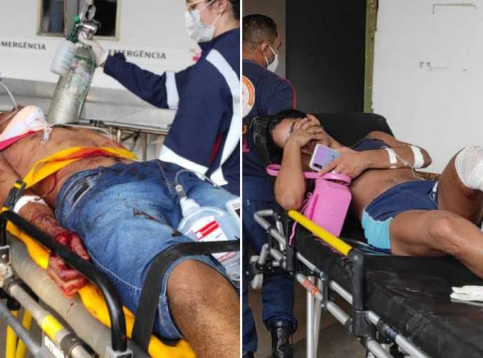 Casal leva oito tiros após criminosos armados invadirem apartamento na Baixada da Sobral
