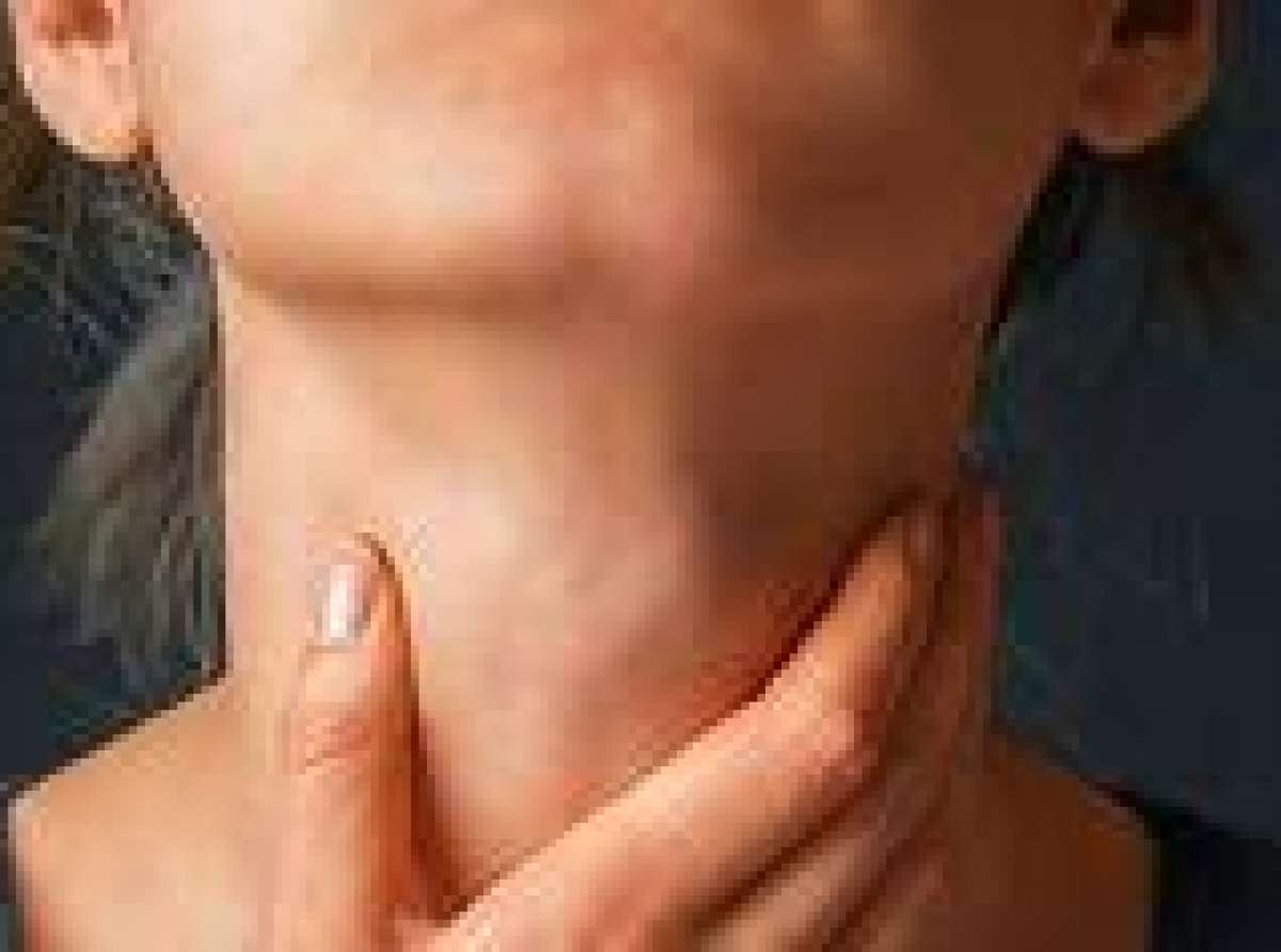 Sexo oral é agora o principal fator de risco para câncer de garganta