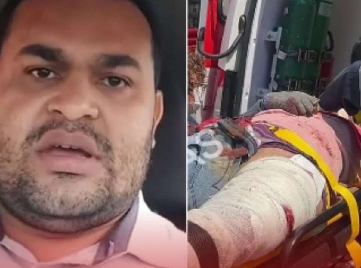 Internautas cobram demissão de assessor da Prefeitura que zombou de trabalhador que sofreu acidente grave; braço direito de Bocalom diz que  "medidas administrativas" estão sendo tomadas